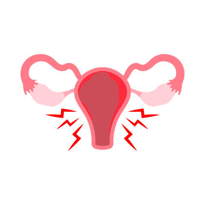 Endometriosis