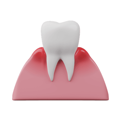 Gum inflammation, gingivitis, periodontitis